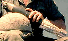 81mm round